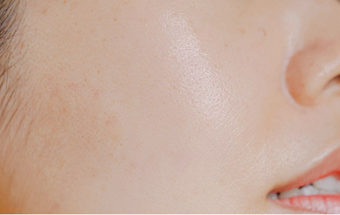 Customer-submitted after photograph associated with DIA Clear Serum