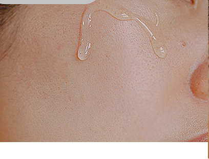 Customer-submitted before photograph associated with DIA Clear Serum