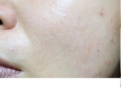 Customer-submitted before photograph associated with DIA Clear Serum