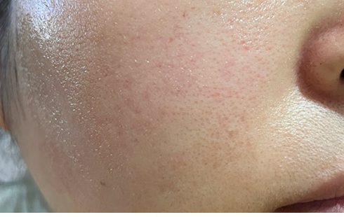 Customer-submitted after photograph associated with DIA Clear Serum