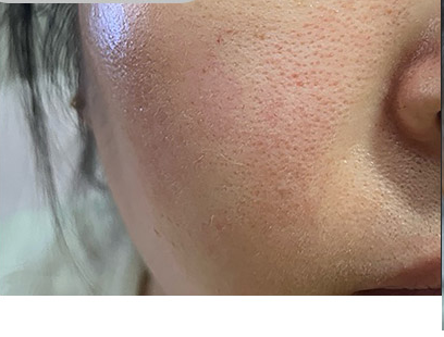 Customer-submitted before photograph associated with DIA Clear Serum