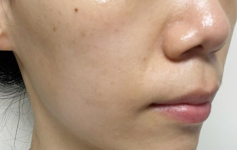 Customer-submitted after photograph associated with DIA Toning Serum
