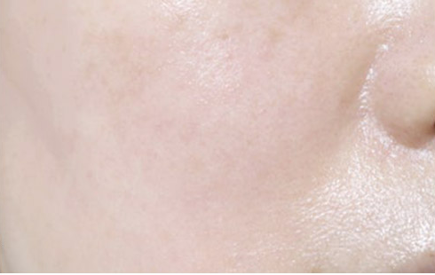 Customer-submitted after photograph associated with DIA Toning Serum