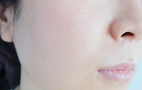 Customer-submitted after photograph associated with DIA Toning Serum