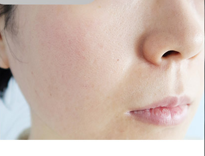 Customer-submitted before photograph associated with DIA Toning Serum