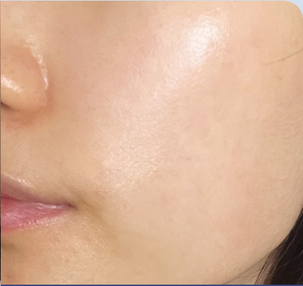 Customer-submitted after photograph associated with Setup Cream [CICA RS]