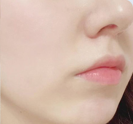 Customer-submitted after photograph associated with Setup Cream [CICA RS]