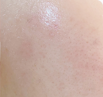 Customer-submitted after photograph associated with Setup Cream [CICA RS]