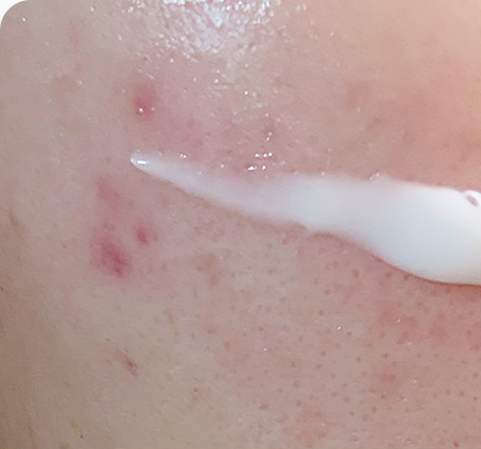 Customer-submitted before photograph associated with Setup Cream [CICA RS]