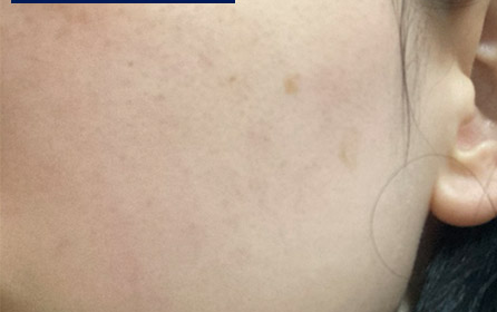 Customer-submitted before photograph associated with Setup Toner [CICA RS]